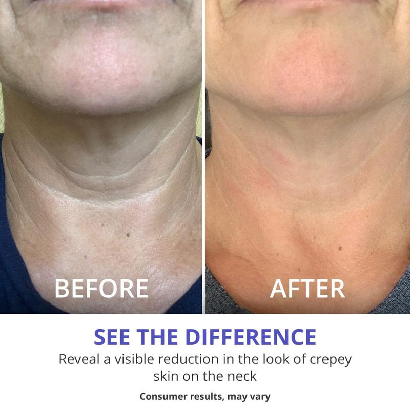 GOPURE Neck Cream - Tighten &amp; Lift Firming Neck Cream for Crepey Skin